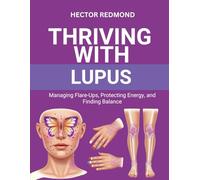 Thriving with Lupus: Managing Flare-Ups, Protecting Energy, and Finding Balance