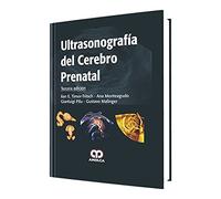 TIMOR TRITSCH ULTRASONOGRAFIA DEL CEREBRO PRENATAL 3E