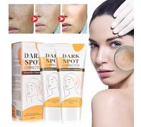 Tkekruh 2PC Crema Blanqueadora de Manchas 60ml, Crema Hidratante Aclarante y Anti Manchas, Crema Antimanchas Facial, Blemish Cream, Anti Manchas Regeneradora y Aclarante, Reduziert Dunkle