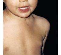 Todavia No/White Color Vinyl [Vinilo]