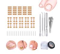Toenails Correction Strips, 2025 New Professional Ingrown Toenails Removal Kit Includes Breathable Ingrown Toenail Strips, Corrector Patch, Pedicure Tools, for Home Use