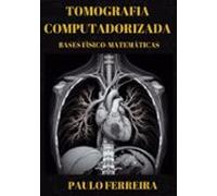 Tomografia Computadorizada: Bases Físico - Matemáticas (ebook)