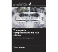 Tomografía computarizada de haz cónico: un nuevo hito en la radiología dental