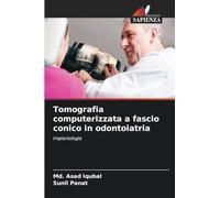 Tomografia computerizzata a fascio conico in odontoiatria: Implantologia