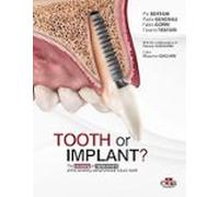 Tooth Or Implant? The Recovery Or Replacement Of The Severely Compromised Natural Tooth