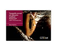 Topografía corneal por elevación mediante Pentacam®: Análisis e interpretación clínica