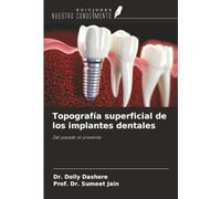 Topografía superficial de los implantes dentales: Del pasado al presente