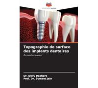 Topographie de surface des implants dentaires: Du passé au présent