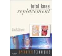 Total Knee Replacement (contains Hardback And Online Resource And Dvd)