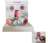 TQPGJJL Modelo de anatomía Avanzada for asma con Placa bilingüe - Modelo 3D de patología bronquial for formación en anatomía y simulación clínica en facultades de Medicina y universidades