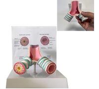 TQPGJJL Modelo De Anatomía Profesional del Asma - Soporte + Placa Bilingue, Exhibición Bronquios Respiratorios Humanos para Docencia Médica, Formación Clínica & Comunicación (PVC