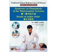 Traditional Chinese Medicine Cures All Diseases: Syndrome on Diapophysis of the Third Lumbar Vertebra Strain of Ankle Joint