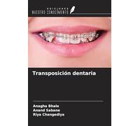 Transposición dentaria