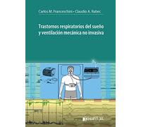 TRASTORNOS RESPIRATORIOS DEL SUEÑO Y VENTILACION MECANICA NO