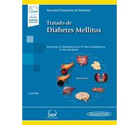 Tratado de Diabetes Mellitus (incluye versión digital)