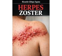 TRATADO DE HERPES ZOSTER