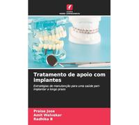Tratamento de apoio com implantes: Estratégias de manutenção para uma saúde peri-implantar a longo prazo
