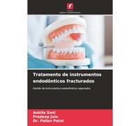 Tratamento de instrumentos endodônticos fracturados: Gestão de instrumentos endodônticos separados