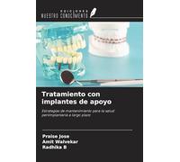 Tratamiento con implantes de apoyo: Estrategias de mantenimiento para la salud periimplantaria a largo plazo