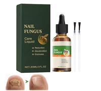 Tratamiento de cuidado de uñas, tratamiento de hongos en las uñas rápido intensivo, repara uñas dañadas/decoloradas, endurecedor de uñas, uñas decoloradas, repara quebradizas