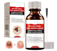 Tratamiento Uñas Pies, Cuidado Uñas Dañadas, Reparadores de Uñas Solución, Fortalece la Uña, La Uña se Regenera de Forma Natural, Restaura el Aspecto Natural de Las Uñas, 30ml