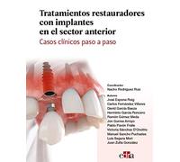 Tratamientos restauradores con implantes en el sector anterior. Casos clínicos paso a paso (n/a)