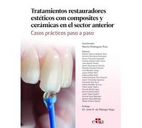 Tratamientos restauradores estéticos con composites y cerámicas en el sector anterior. Casos prácticos paso a paso