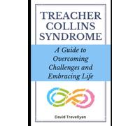 Treacher Collins Syndrome: A Guide to Overcoming Challenges and Embracing Life