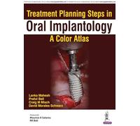 Treatment Planning Steps in Oral Implantology: A Color Atlas