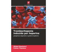 Trombocitopenia induzida por heparina: patogénese diagnóstico e gestão terapêutica
