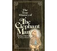 True History of the Elephant Man