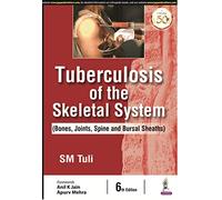Tuberculosis of the Skeletal System