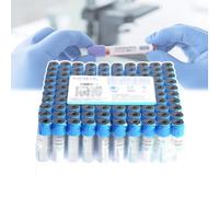 Tubo desechable de extracción de sangre al vacío, citrato de sodio 1:9, recogida de sangre a presión negativa, 100 unidades para recoger muestras de sangre, 5 ml