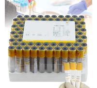 Tubos desechables de extracción de sangre al vacío, tubos de recolección de sangre de vidrio con gel de separación, 100 unidades para separación de suero y preparación de PRP, tapa amarilla