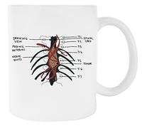 Tumor de la anatomía de Grey Taza De Cerámica Blanca Para Taza De Café Para Té