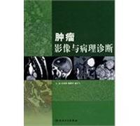 Tumor imaging with pathological diagnosis (Author: Xiangquan Ed.) (Price: 315.00) (Publisher: People's Medical Publishing House) (ISBN: 9787117120890)(Chinese Edition)