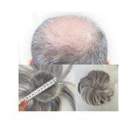 Tupé de pelo para hombres Peluquín con parche for calvicie for hombres de 3,15 x 3,15 pulgadas, base de piel fina de PU, parches for el cabello, postizos for hombres, sistemas de reemplazo de cabello