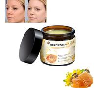 Turonu Bee Venom Cream, Turonu 2024 New Bee Venom Repair Cream, nueva crema profesional reparadora de veneno de abeja para hombres y mujeres, para todo tipo de piel (1pcs)