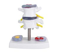Tyenaza Modelo Lumbar Modelo, Disco Lumbar Anatómico, Modelo de Hernia de Disco Lumbar Humano, Modelo de VéRtebras Lumbares con Base Desmontable, Modelo de Lumbar para Enseñanza Médica y Escolar