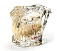 Uadme Modelo de Demostración Dental de Dientes Transparente Desmontable, Fantoma Dental Estándar para Enseñanza, Cuidado Bucal