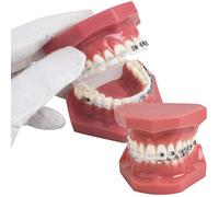 UIGJIOG Dientes de ortodoncia Modelo, Dental Modelo de demostración,Teach Herramientas de Estudio con el Metal y el Soporte de cerámica