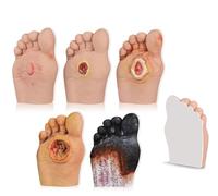 UIGJIOG Modelo Anatómico 5 Piezas Modelo de Cuidado del Pie Diabético Grado 1-5 Simulador de Enfermería del Pie Diabético Modelo de Pie Humano para Anatomía, Fisiología y Demostraciones