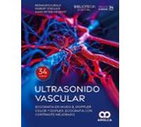 Ultrasonido Vascular. Ecografía En Modo B Doppler Color Y Duplex Ecogr