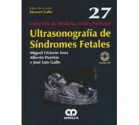 Ultrasonografia De Sindromes Fetales