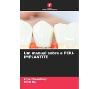 Um manual sobre a PERI-IMPLANTITE
