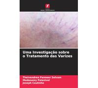 Uma Investigação sobre o Tratamento das Varizes