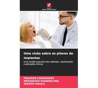 Uma visão sobre os pilares de implantes: Uma revisão exaustiva dos materiais, classificações e aplicações clínicas