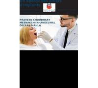 Un aperçu des piliers d'implants: Un examen complet des matériaux, des classifications et des applications cliniques