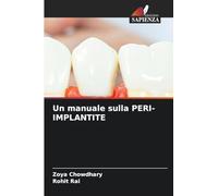 Un manuale sulla PERI-IMPLANTITE