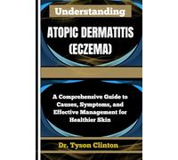 UNDERSTANDING ATOPIC DERMATITIS (ECZEMA): A Comprehensive Guide to Causes, Symptoms, and Effective Management for Healthier Skin